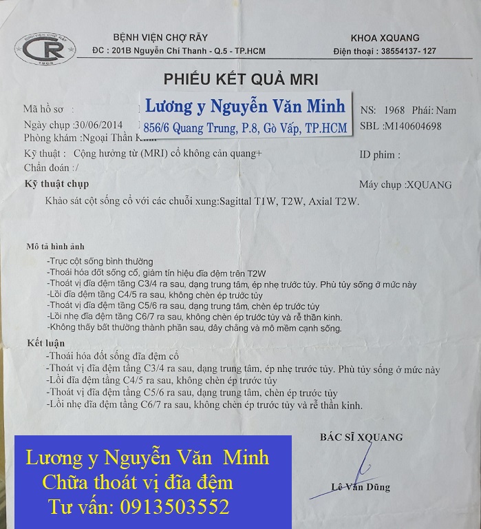 MRI- thoat-vi-dia-dem-co